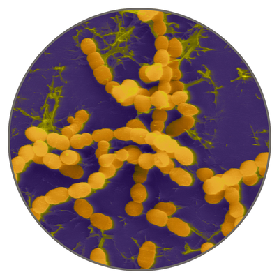 Thermus Thermophilus Ferment